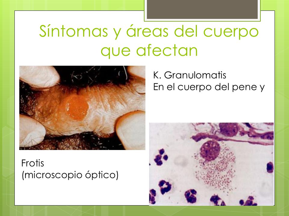 Pneumoniae sintomas klebsiella
